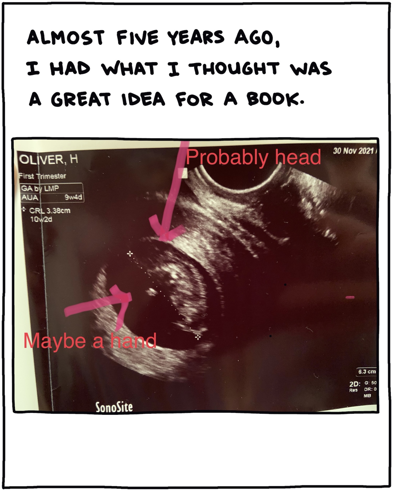 Almost five years ago, I had what I thought was a great idea for a book. [ultrasound photo]